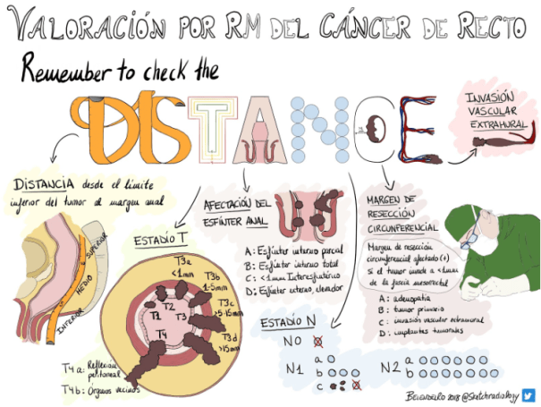 DISTANCE_BelenDelRio